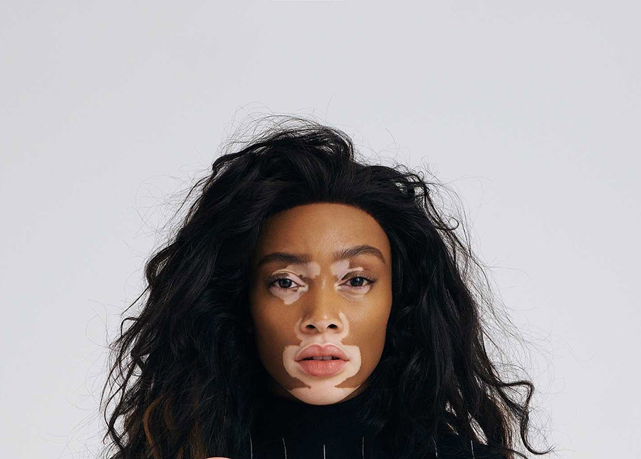 Winnie-harlow-EXCLAMA-3